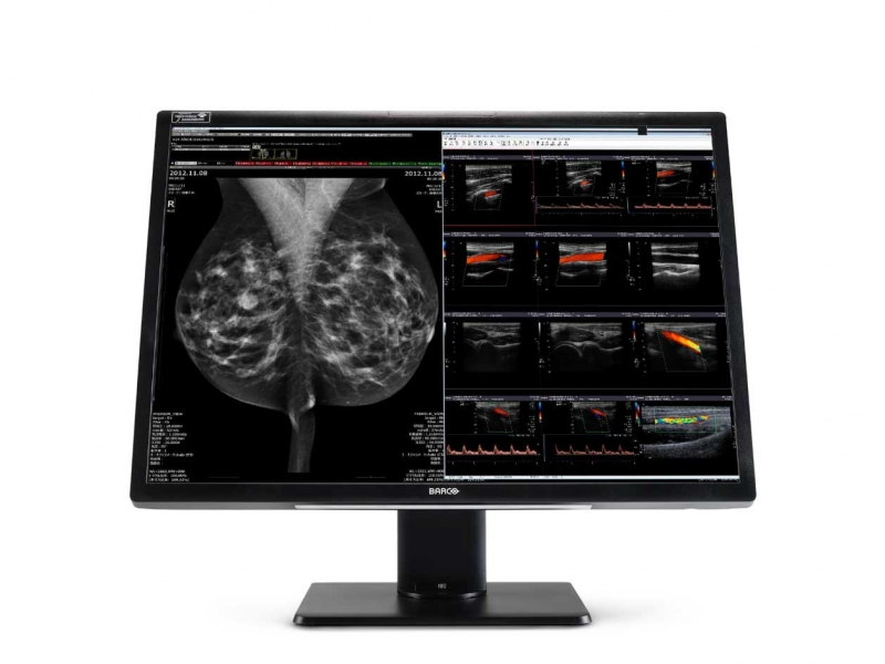Màn hình y tế Barco MDNC-12130